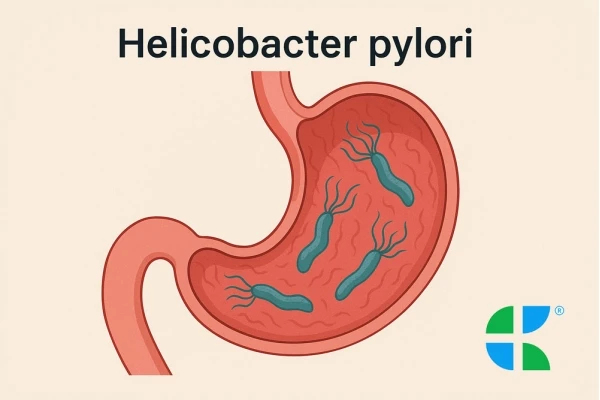 Helicobacter pylori - objawy zakażenia i możliwości leczenia