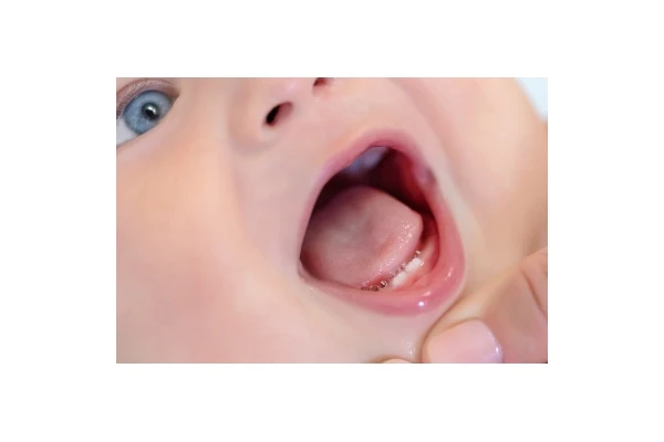 Ząbkowanie u niemowląt - ile trwa i jakie są objawy. Sposoby na bolesne ząbkowanie