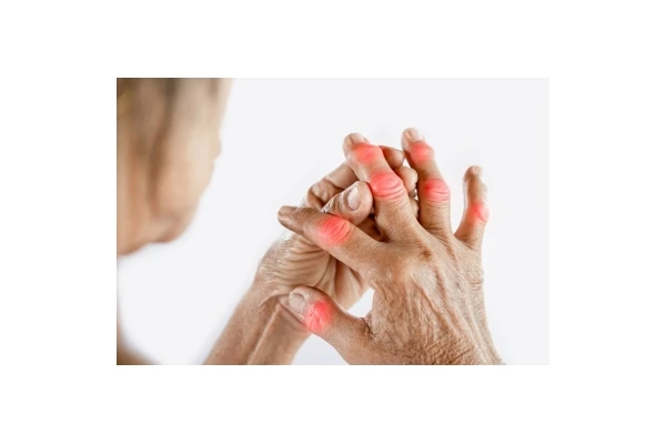 Zapalenie stawów - przyczyny, objawy i leczenie