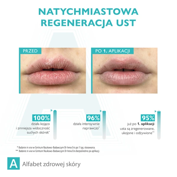 Pharmaceris A ULTRA-SERUM REGENERUJĄCE na spierzchnięte usta, z tendencją do pękania, 15 ml 4